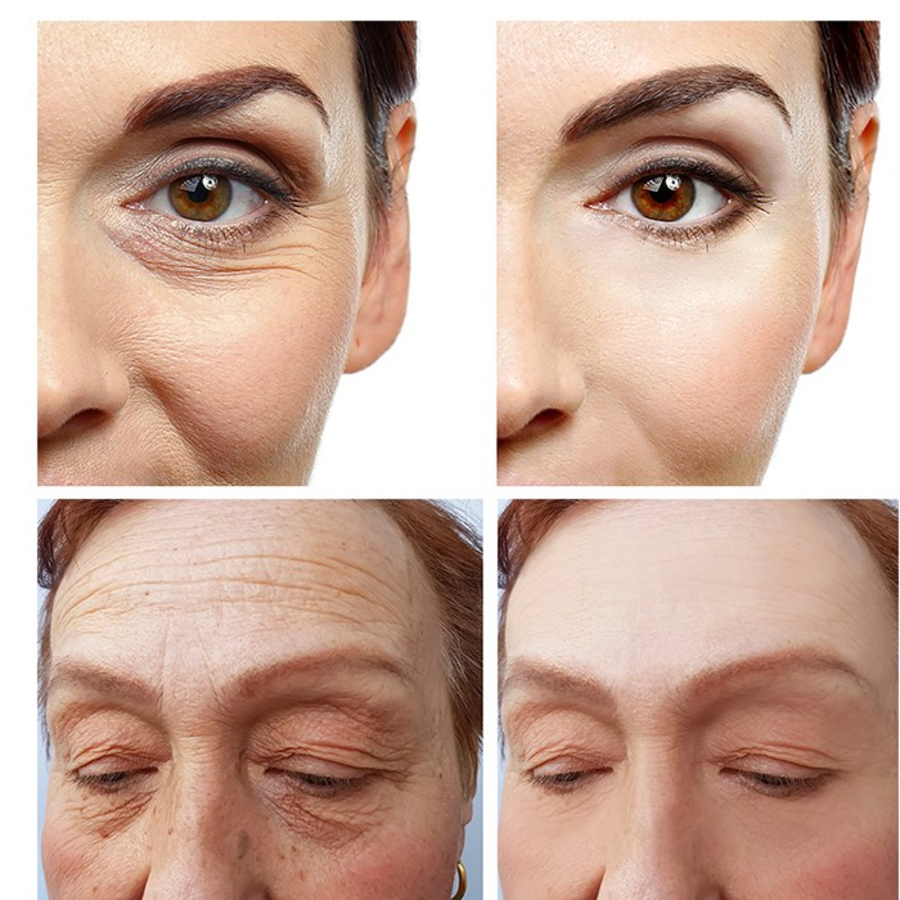 Hillseed Refreshing Carrot Eye Cream – освежающий крем для глаз с экстрактом моркови, 30 мл 1 шт