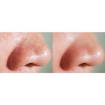 Гель-пилинг Heal Seed Amazing Aqua, 150 мл