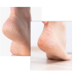 Dashu Relax Отшелушивающий крем для ног с высоким содержанием влаги, 70 мл, 1 шт. (скидка-47%)