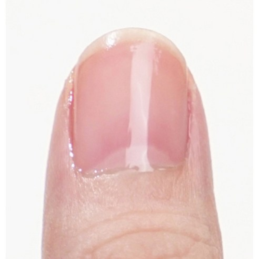 Питательное средство для ногтей Appleton Newsen, 10 мл