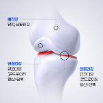 Care rance Joint Cartilage Mucopolysaccharide Chondroitin 1200+ Vitamin D + Manganese Triple Action – добавка для суставов и хрящей, 6 г