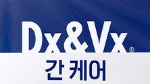 DX&VX