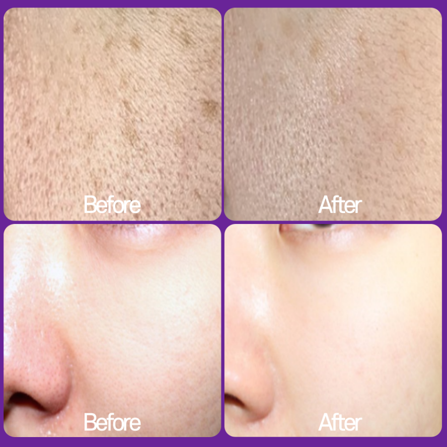 RX Derma Whitening Vita A Cream Retinal 1300ppm – ночной крем с ретиналом и витамином A, 20 г