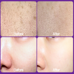 RX Derma Whitening Vita A Cream Retinal 1300ppm – ночной крем с ретиналом и витамином A, 20 г